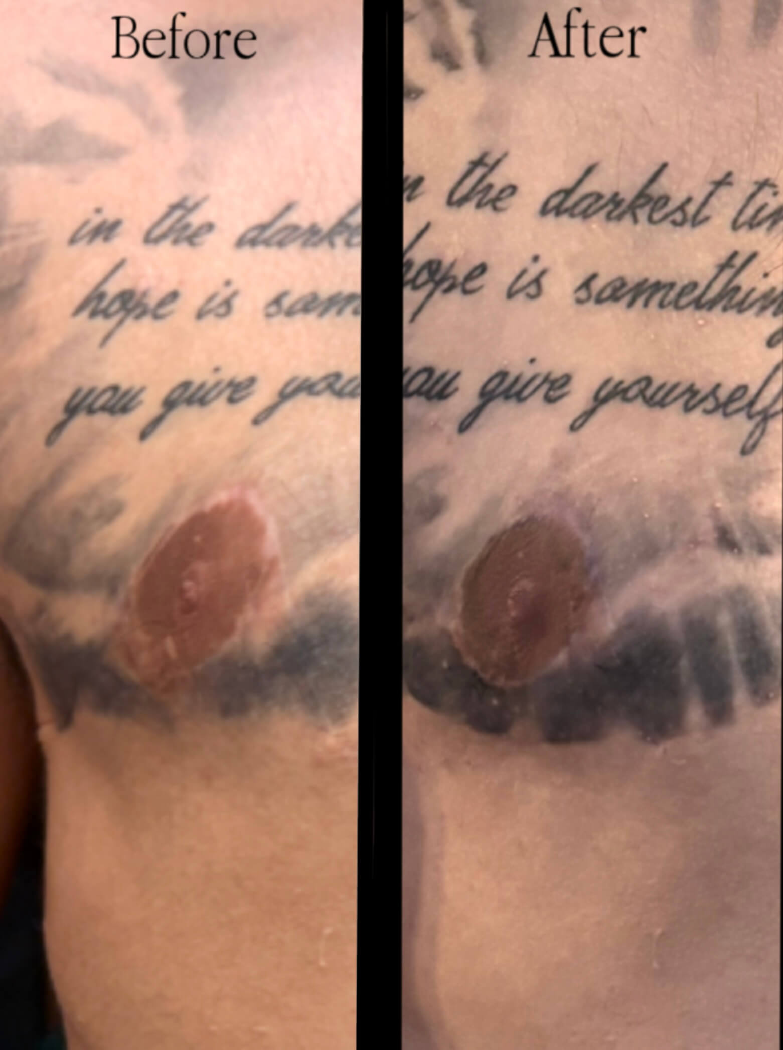 Mens 3d areola tattoo